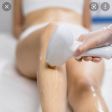 depilazione laser